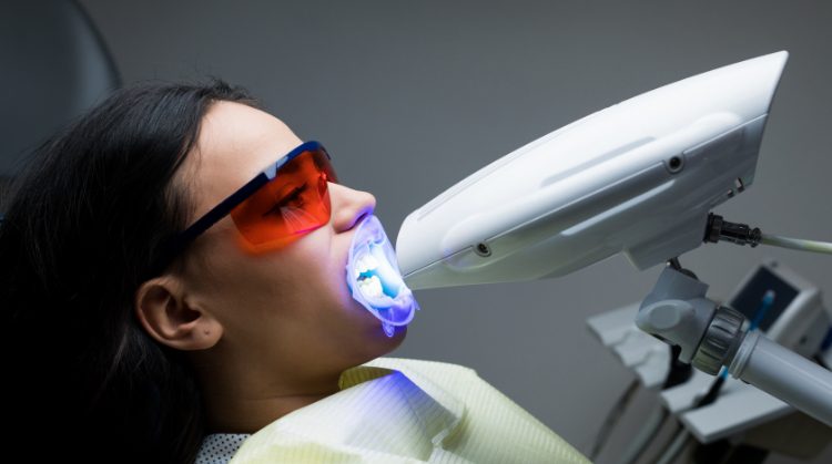 A patient undergoing professional teeth whitening at Downtown Plaza Dental in Sacramento, CA. The procedure uses a specialized light to enhance whitening results.