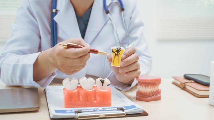 Dentist at Downtown Plaza Dental in Sacramento, CA explaining chipped or cracked tooth with a dental model.